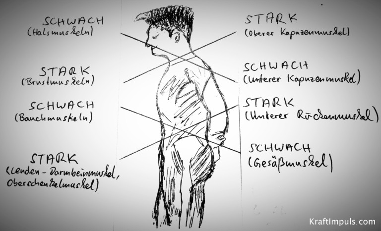 muskuläre dysbalance bilder